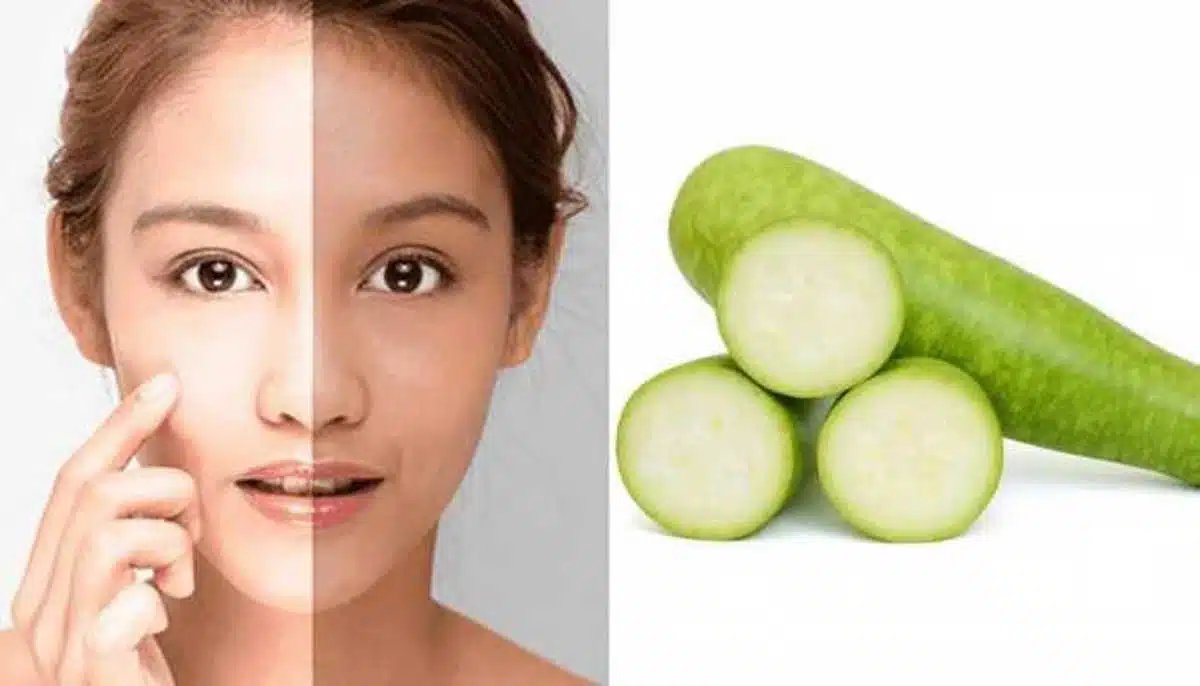 5 Incredible Benefits Of Bottle Gourd For Skin