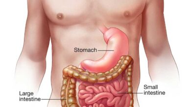 What is Acute gastroenteritis? Know causes symptoms prevention