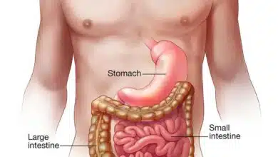 What is Acute gastroenteritis? Know causes symptoms prevention