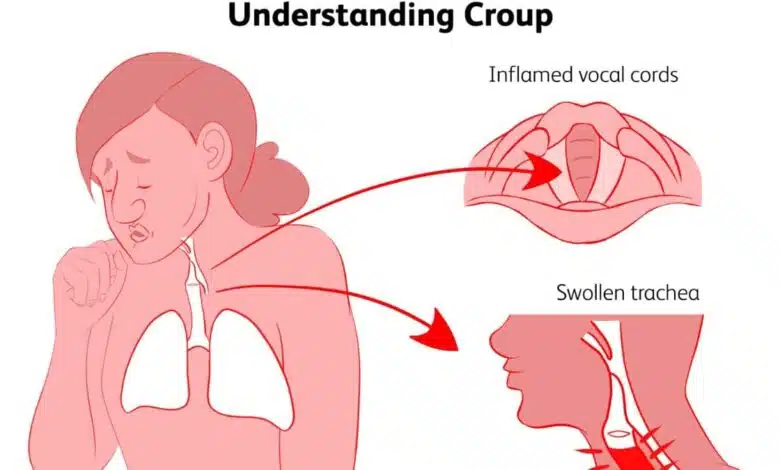 detailed-information-Cough-definition