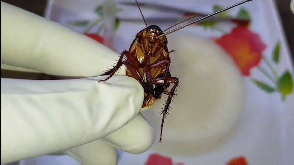 Delhi doctors save man life by removing live cockroach from his intestines