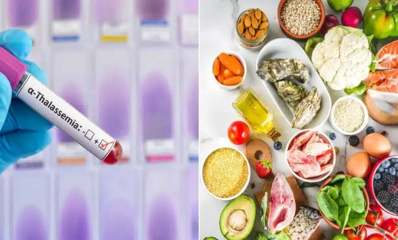 Diet for a person suffering from Thalassemia Minor