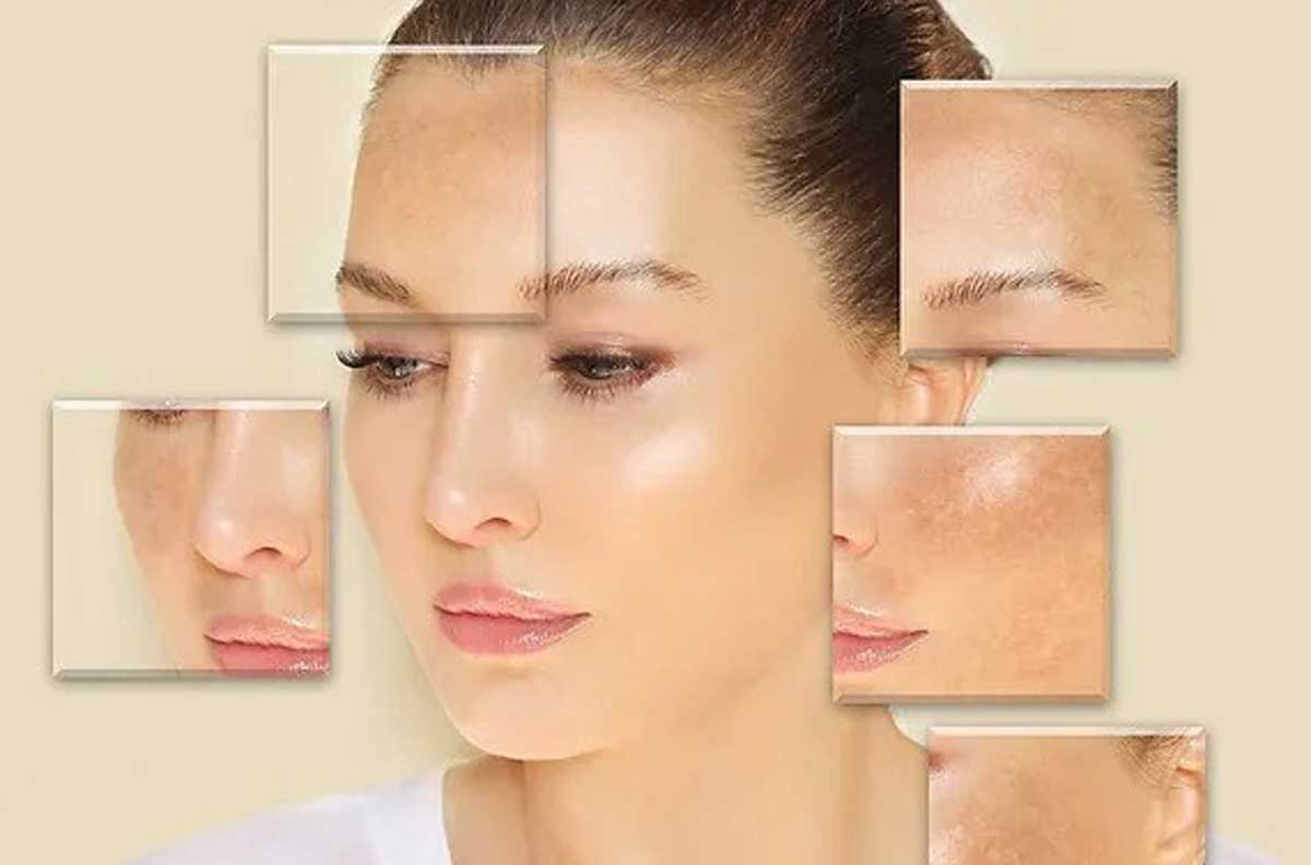 Dull Skin Causes, Effects and Solutions