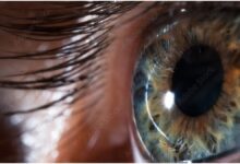 What are the reasons for weak eyesight