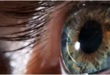 What are the reasons for weak eyesight