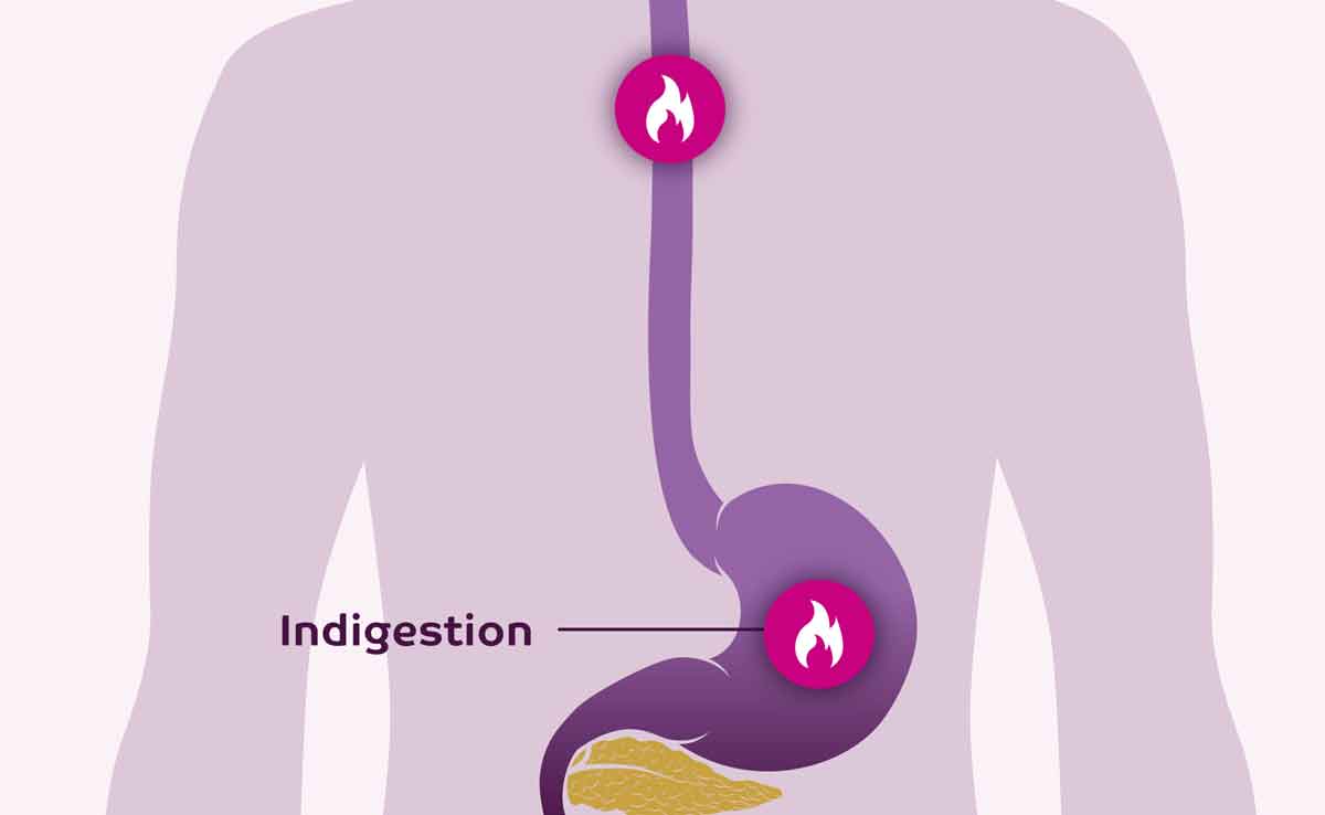 What is indigestion? Symptoms and treatment 