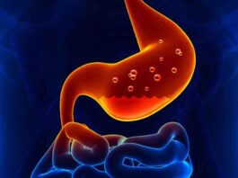 What is indigestion? Symptoms and treatment