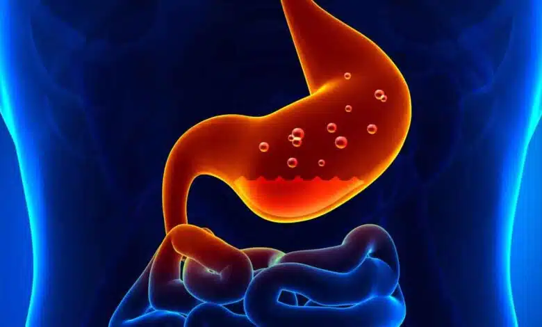 What is indigestion? Symptoms and treatment