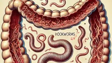 Detailed information about intestinal worms?