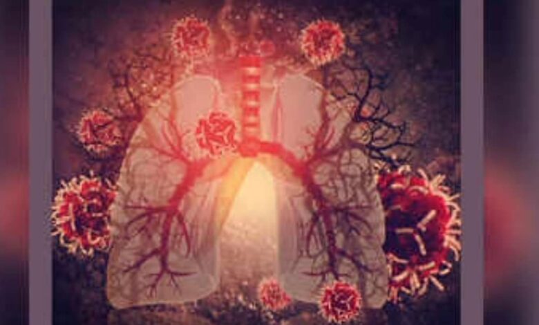 Causes of cough and its symptoms