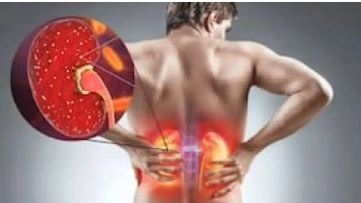 What is kidney disease?