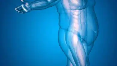 What is obesity? And what causes it?