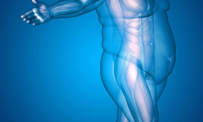 What is obesity? And what causes it?