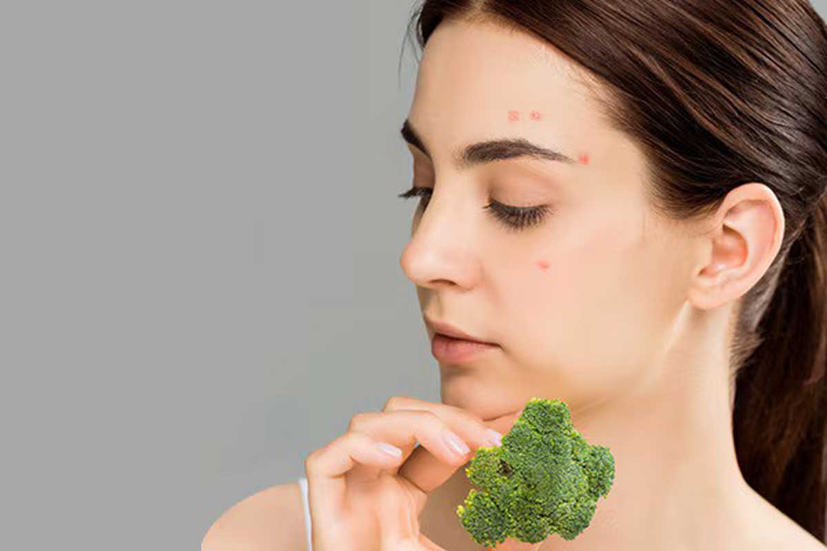 Skin Health 5 amazing benefits of broccoli for skin you should know