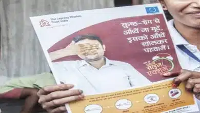 Society's attitude towards leprosy