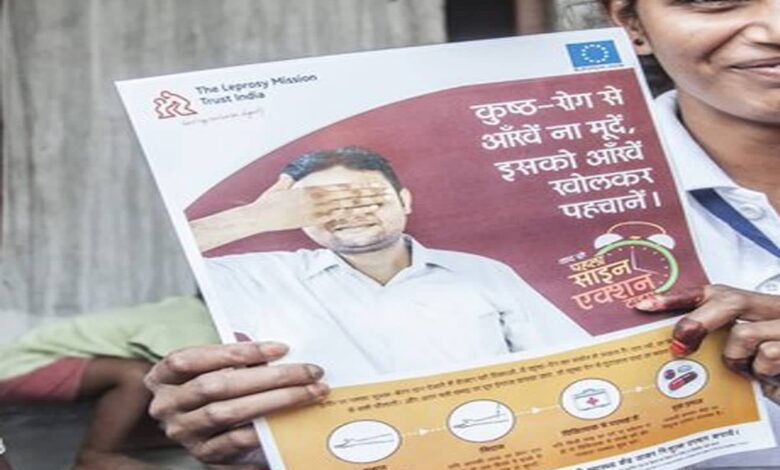 Society's attitude towards leprosy