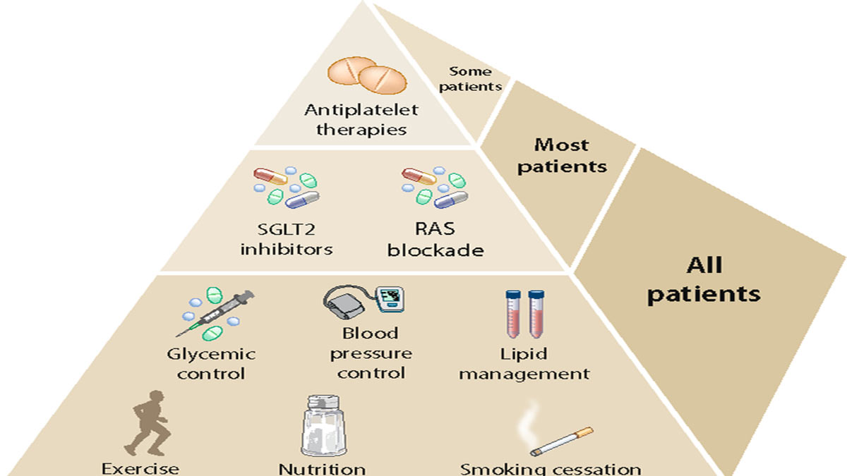 Kidney Disease: A Comprehensive Guide to Prevention and Treatment