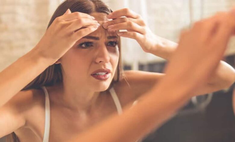 What to apply on the face to remove acne