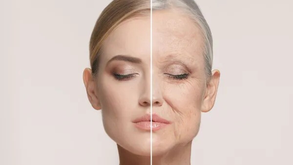 Wrinkles: Causes, Types and Solutions