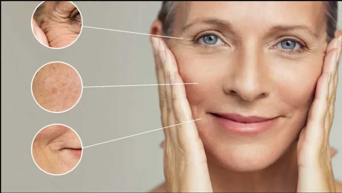 Wrinkles: Causes, Types and Solutions