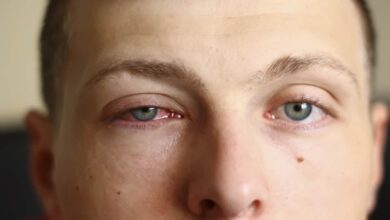 Eye Swelling: 5 Foods That Help Reduce Eye Swelling
