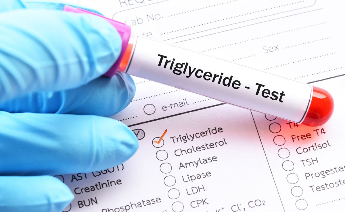 lowers Triglyceride Levels