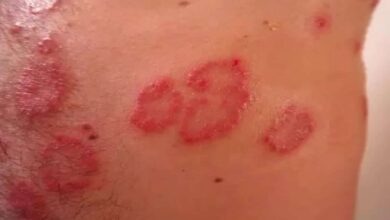 What is skin disease? And how does it occur?