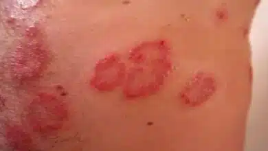 What is skin disease? And how does it occur?