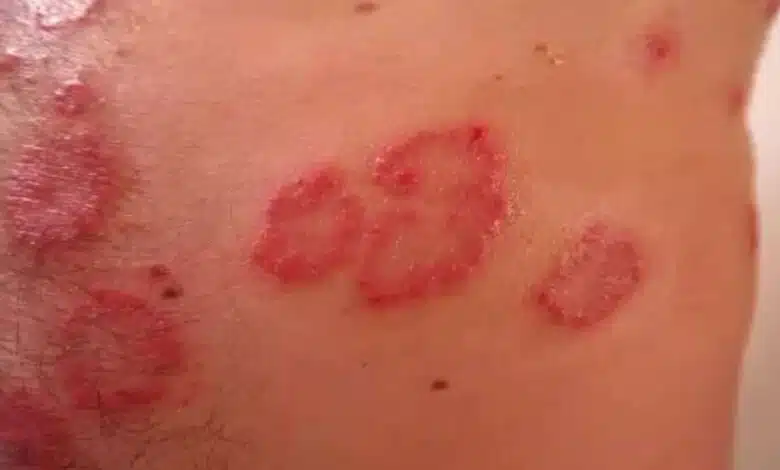 What is skin disease? And how does it occur?