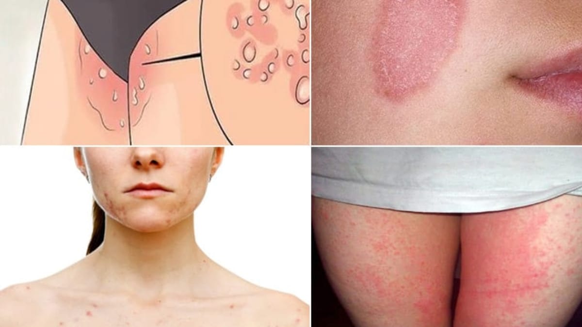 What is skin disease? And how does it occur?