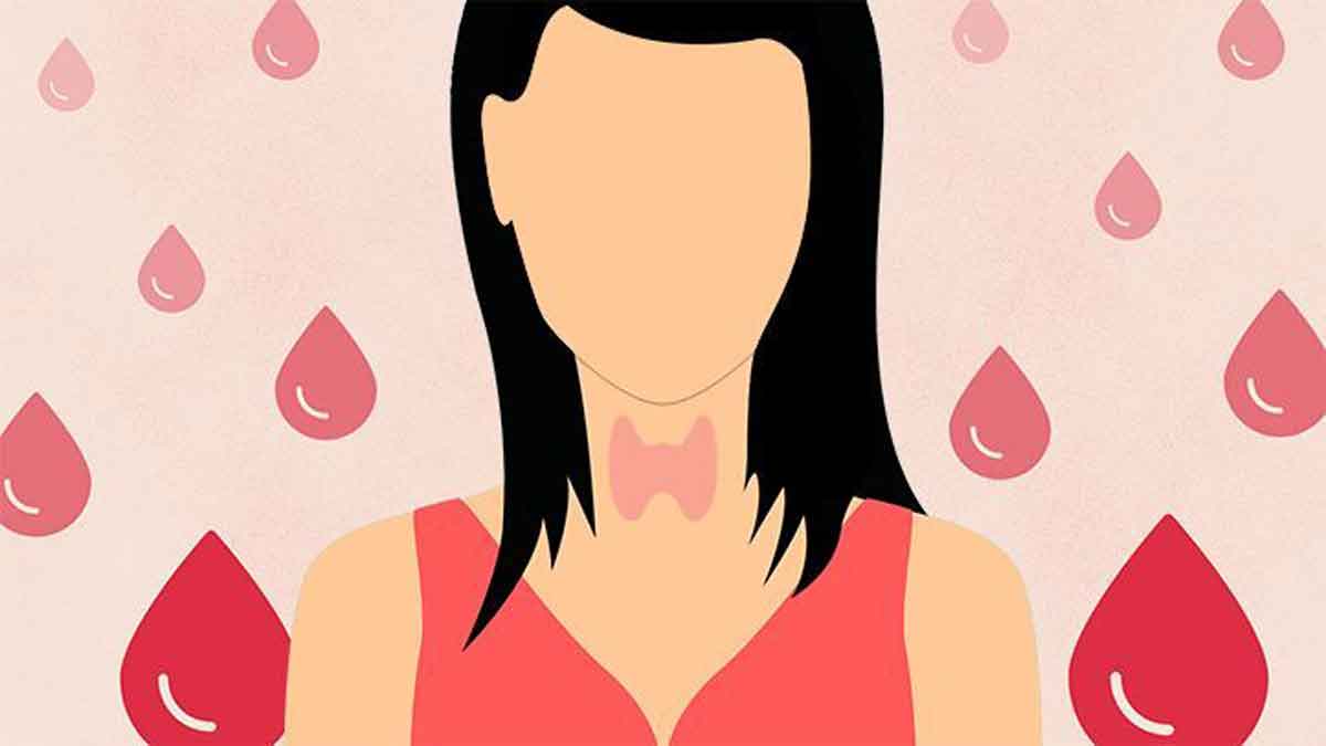 10 Common Causes of Irregular Menstruation