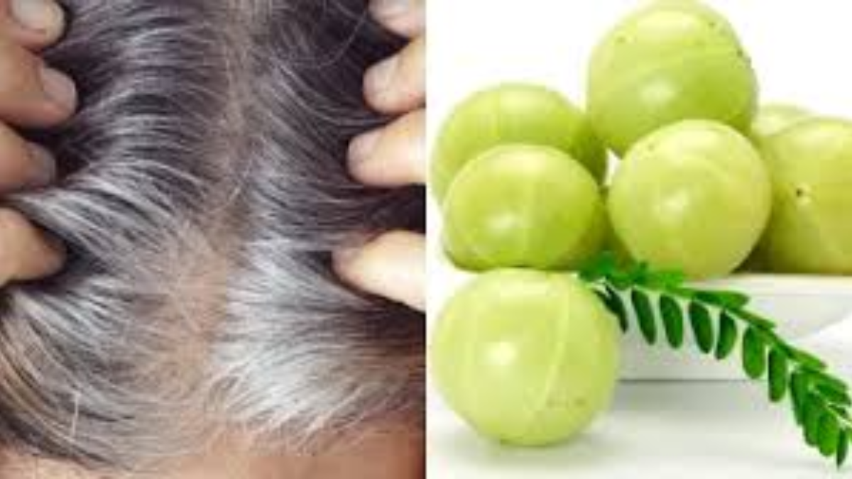 Amla, consume it like this to grow hair quickly