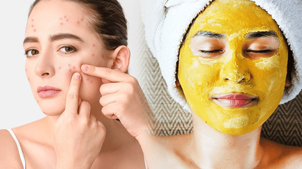 How to remove dark spots from face with Turmeric