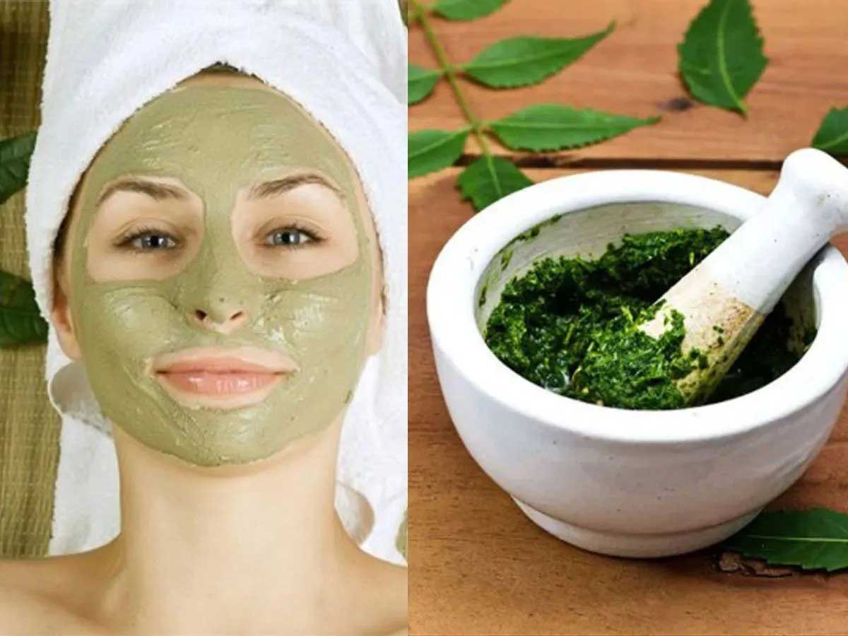 Neem is a natural remedy to get rid of dandruff