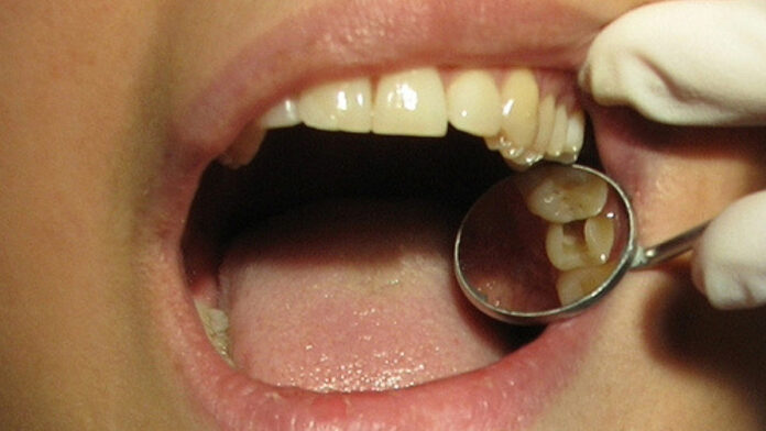 Root canal treatment of teeth