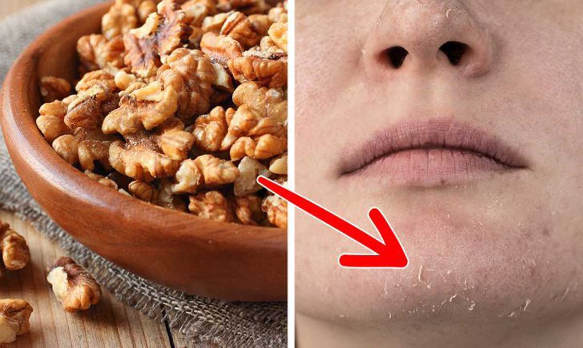 Skin Care 5 benefits of walnuts for smooth and glowing skin