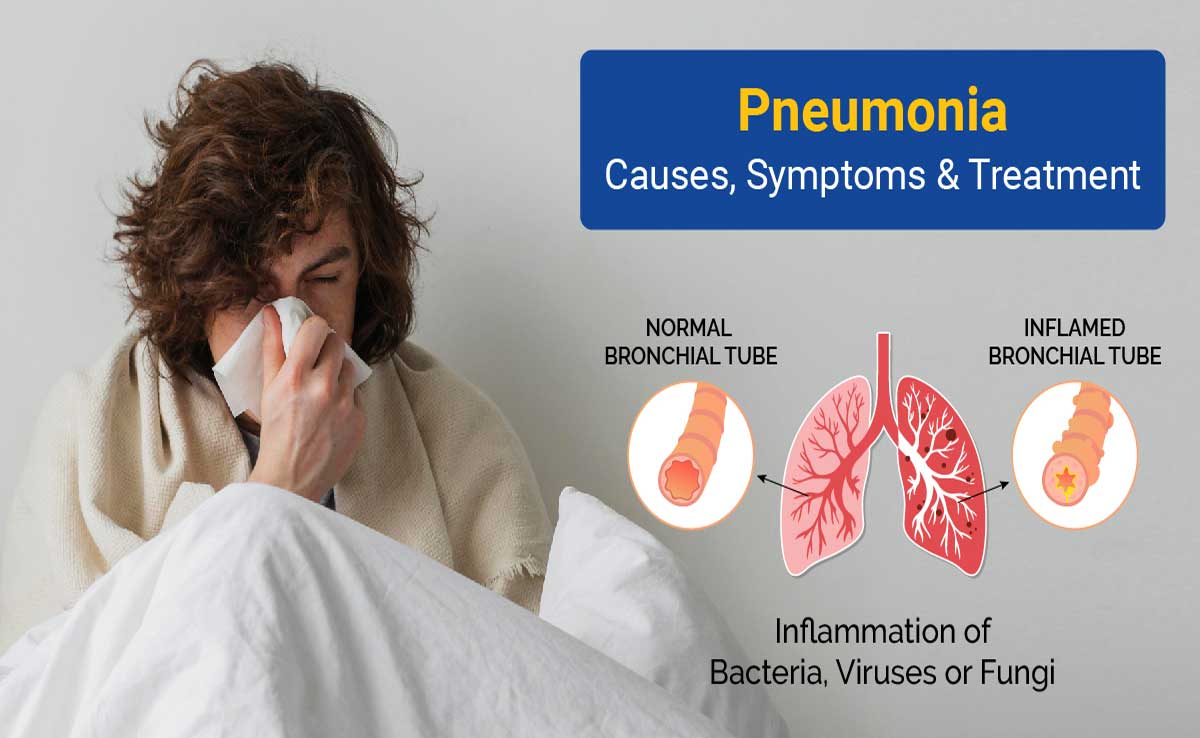 Understanding of Pneumonia in Seniors