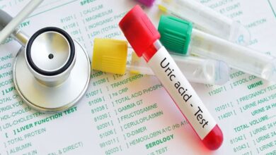 Do you want to control Uric Acid level? Include bananas in your diet, know when and how to consume them