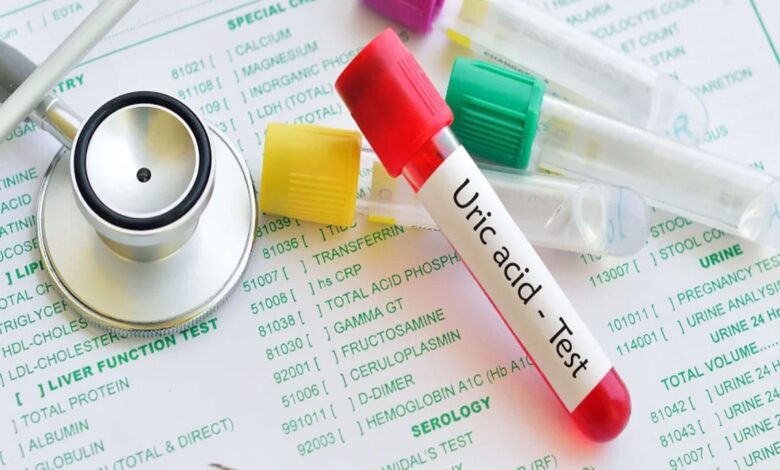 Do you want to control Uric Acid level? Include bananas in your diet, know when and how to consume them