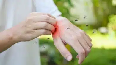 What Are the Long-Term Effects of Dengue