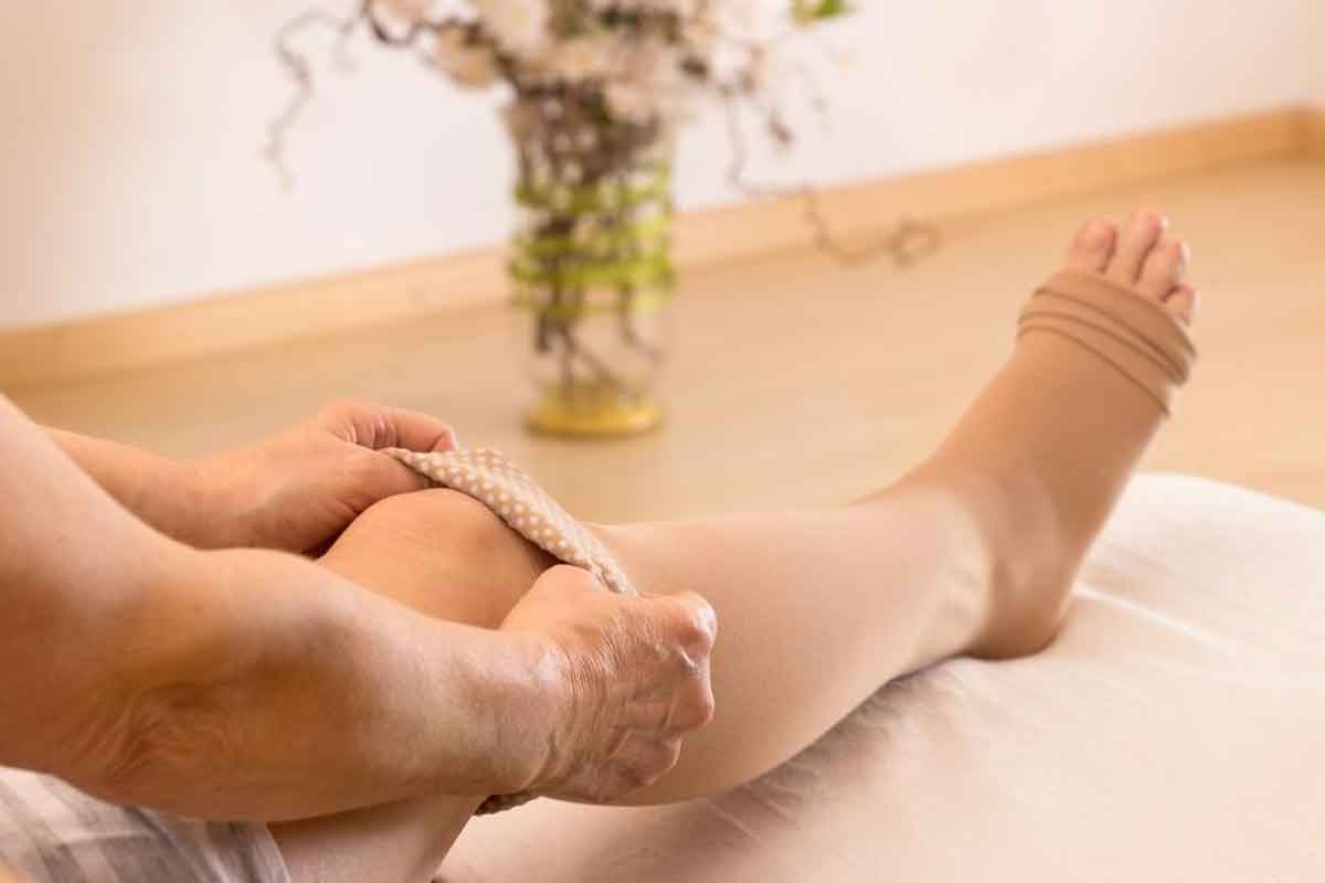 A Comprehensive Introduction to Varicose Veins