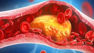 Radish is beneficial in bad cholesterol, know its other benefits