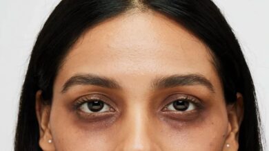 If you are troubled by dark circles, then try these oils to lighten them naturally.