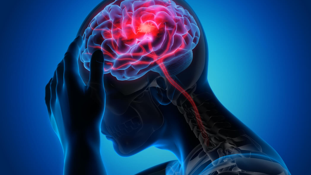 Headache: Causes, types, and prevention