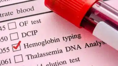 Hemoglobin increases from 7 to 14 in a week