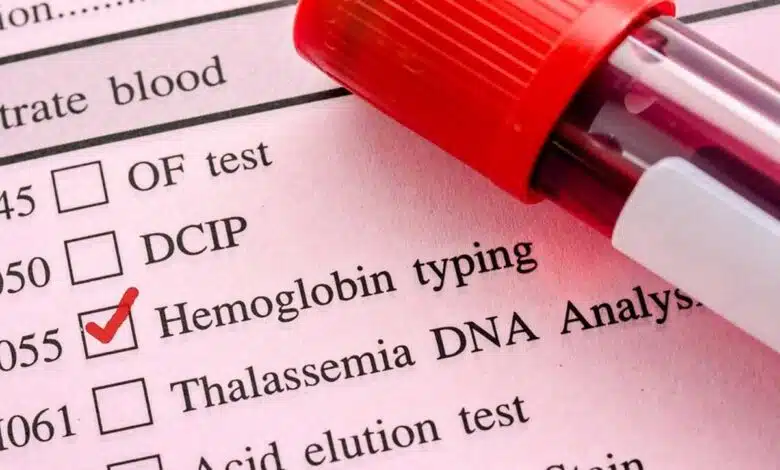 Hemoglobin increases from 7 to 14 in a week