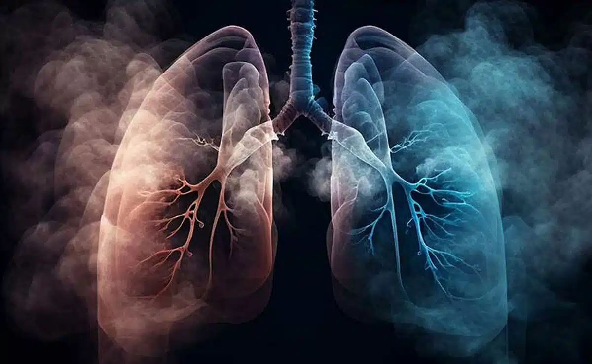 What are the main risk factors for Lung Cancer and how is it treated?