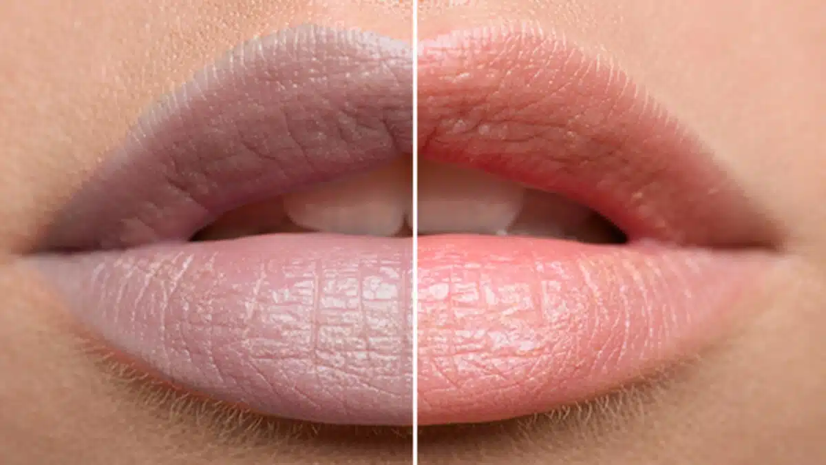 Tips to remove dark lips