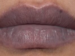 Tips to remove dark lips