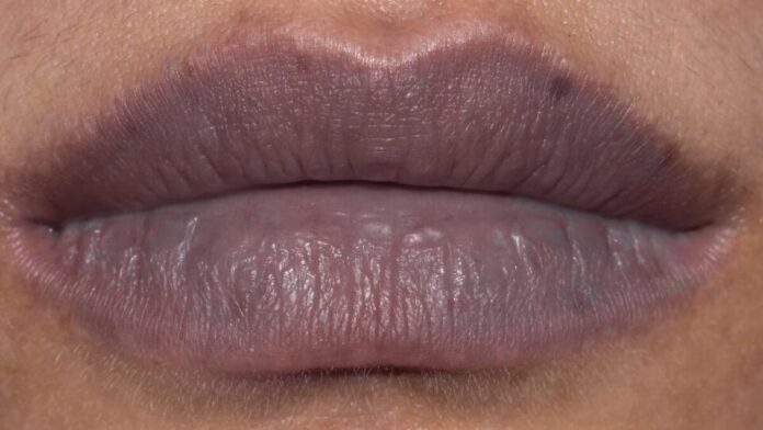 Tips to remove dark lips